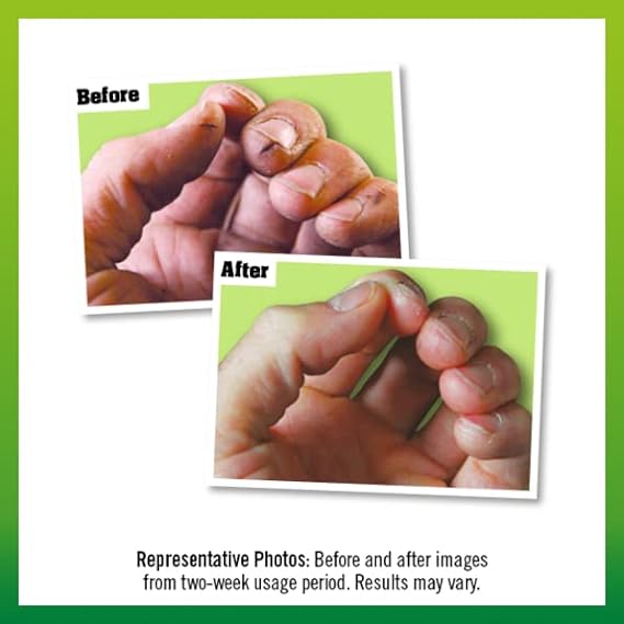 Two photos of a hand: the Before image shows dirty, rough nails, while the After image—set against green—shows cleaner, healthier-looking nails thanks to OKeeffes Working Hands Tube (80ML) by OKeeffes.