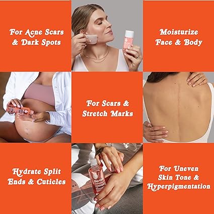 A grid of six images showcases Bio-Oil Skincare Oil (200ml) by Bio-Oil, emphasizing its versatility for acne scars, moisturizing, scars and stretch marks, hydrating cuticles, and uneven skin tone. Each panel features someone applying or holding the product to illustrate its effectiveness.