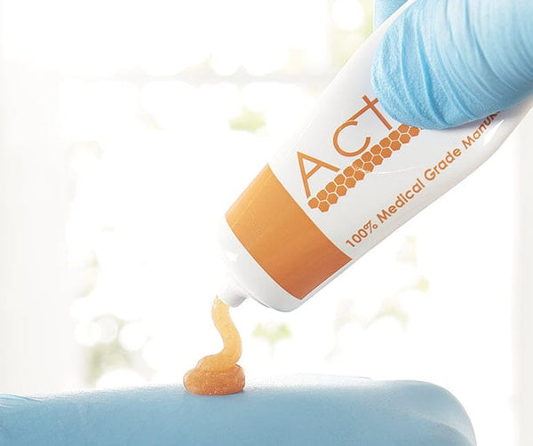 A person in a blue glove dispenses honey-colored ointment from an Advancis Activon Manuka Honey Tube (25g), highlighting the natural healing benefits of manuka honey against a softly blurred background.